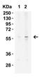 Kringle Containing Transmembrane Protein 2 antibody, A11875, Boster Biological Technology, Western Blot image 