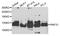 Ring Finger Protein 31 antibody, A8227, ABclonal Technology, Western Blot image 