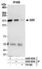SIK Family Kinase 3 antibody, A302-455A, Bethyl Labs, Immunoprecipitation image 