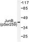 JunB Proto-Oncogene, AP-1 Transcription Factor Subunit antibody, LS-C177918, Lifespan Biosciences, Western Blot image 