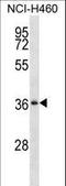 Serpin Family B Member 1 antibody, LS-C168985, Lifespan Biosciences, Western Blot image 