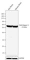 Calcium/Calmodulin Dependent Protein Kinase II Alpha antibody, GTX22725, GeneTex, Western Blot image 