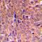 SRC Proto-Oncogene, Non-Receptor Tyrosine Kinase antibody, orb214605, Biorbyt, Immunohistochemistry paraffin image 