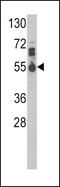 Interleukin 17 Receptor B antibody, GTX81729, GeneTex, Western Blot image 