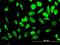 Ribosomal Protein S23 antibody, H00006228-M02, Novus Biologicals, Immunofluorescence image 