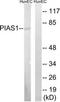 Protein Inhibitor Of Activated STAT 1 antibody, TA326261, Origene, Western Blot image 