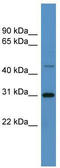 Zinc Finger Protein 696 antibody, TA341409, Origene, Western Blot image 
