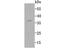 RAD51 Recombinase antibody, A00088-1, Boster Biological Technology, Western Blot image 