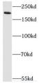 Vir Like M6A Methyltransferase Associated antibody, FNab04543, FineTest, Western Blot image 