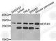 Eukaryotic Translation Initiation Factor 4H antibody, A9953, ABclonal Technology, Western Blot image 