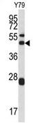 Actin Related Protein 2/3 Complex Subunit 1A antibody, AP17130PU-N, Origene, Western Blot image 