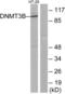 DNA Methyltransferase 3 Beta antibody, LS-B5671, Lifespan Biosciences, Western Blot image 