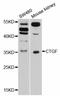 Cellular Communication Network Factor 2 antibody, LS-C746979, Lifespan Biosciences, Western Blot image 