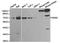 Golgi Associated, Gamma Adaptin Ear Containing, ARF Binding Protein 2 antibody, TA326980, Origene, Western Blot image 