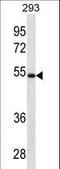 Legumain antibody, LS-B9325, Lifespan Biosciences, Western Blot image 