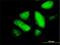 Glutathione S-Transferase Zeta 1 antibody, H00002954-M01, Novus Biologicals, Immunocytochemistry image 