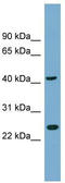 Tetratricopeptide Repeat Domain 23 Like antibody, TA340367, Origene, Western Blot image 