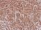 Nuclear RNA Export Factor 3 antibody, NBP2-19614, Novus Biologicals, Immunohistochemistry paraffin image 