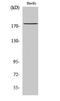 ATP Binding Cassette Subfamily A Member 8 antibody, STJ91409, St John