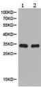 Uncoupling Protein 3 antibody, TA321571, Origene, Western Blot image 
