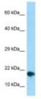 Nuclear Protein 1, Transcriptional Regulator antibody, NBP1-98280, Novus Biologicals, Western Blot image 