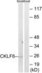 CKLF Like MARVEL Transmembrane Domain Containing 6 antibody, LS-C119857, Lifespan Biosciences, Western Blot image 