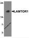 Late Endosomal/Lysosomal Adaptor, MAPK And MTOR Activator 1 antibody, 7709, ProSci, Western Blot image 