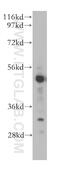 Retinoic Acid Receptor Beta antibody, 14013-1-AP, Proteintech Group, Western Blot image 