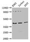 Adiponectin Receptor 1 antibody, LS-C498307, Lifespan Biosciences, Western Blot image 