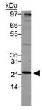 Proteasome 26S Subunit, Non-ATPase 10 antibody, GTX48519, GeneTex, Western Blot image 