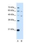 Cysteine Rich With EGF Like Domains 1 antibody, NBP1-59928, Novus Biologicals, Western Blot image 