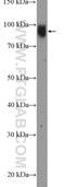 Upstream Binding Transcription Factor antibody, 20660-1-AP, Proteintech Group, Western Blot image 