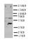 Solute Carrier Family 22 Member 6 antibody, orb76197, Biorbyt, Western Blot image 