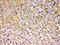 SOD3 antibody, PB9747, Boster Biological Technology, Immunohistochemistry paraffin image 