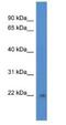 DiGeorge Syndrome Critical Region Gene 6 Like antibody, NBP1-79875, Novus Biologicals, Western Blot image 