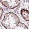 LSM Family Member 14B antibody, HPA061189, Atlas Antibodies, Immunohistochemistry paraffin image 