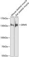 Glutamate Metabotropic Receptor 5 antibody, GTX66581, GeneTex, Western Blot image 