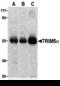 Tripartite motif-containing protein 5 antibody, 3249, ProSci, Western Blot image 