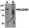 Small G Protein Signaling Modulator 2 antibody, 7035, ProSci, Western Blot image 