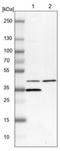 Carbohydrate Sulfotransferase 10 antibody, NBP1-81727, Novus Biologicals, Western Blot image 