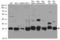Casein Kinase 2 Beta antibody, LS-C796575, Lifespan Biosciences, Western Blot image 