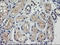 Tripartite Motif Containing 38 antibody, LS-C174623, Lifespan Biosciences, Immunohistochemistry paraffin image 