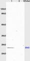 Glial Cell Derived Neurotrophic Factor antibody, GTX17447, GeneTex, Western Blot image 