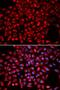 Aminoacyl TRNA Synthetase Complex Interacting Multifunctional Protein 1 antibody, LS-B13385, Lifespan Biosciences, Immunofluorescence image 