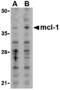 MCL1 Apoptosis Regulator, BCL2 Family Member antibody, MBS151231, MyBioSource, Western Blot image 