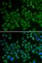 Sphingomyelin Phosphodiesterase 1 antibody, orb247604, Biorbyt, Immunofluorescence image 