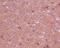 Neurotrophic Receptor Tyrosine Kinase 1 antibody, M00706, Boster Biological Technology, Immunohistochemistry paraffin image 