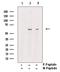 Receptor Interacting Serine/Threonine Kinase 3 antibody, GTX00838, GeneTex, Western Blot image 