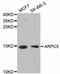 Actin Related Protein 2/3 Complex Subunit 5 antibody, abx125292, Abbexa, Western Blot image 