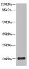 Protein Phosphatase 3 Regulatory Subunit B, Beta antibody, LS-C676307, Lifespan Biosciences, Western Blot image 